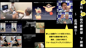 【開催報告】第45回 JNOSウェビナー Dr木村＆Dr小林の腰殿部・下肢痛 ～応用編②～(2022年2月26日開催)