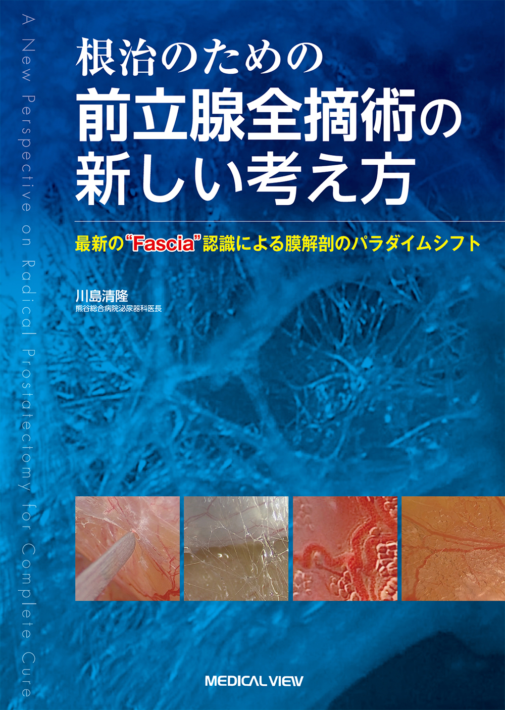 書籍]根治のための 前立腺全摘術の新しい考え方 – 最新の“Fascia”認識