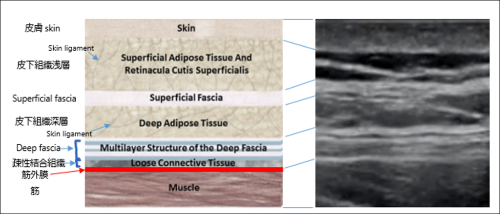 皮下組織の構造(模式図)とエコー画像の関連性(2017年 小林只作成)